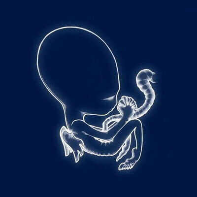 Sigur Ros | Agaetis Byrjun | 2Vinyl LP - Black